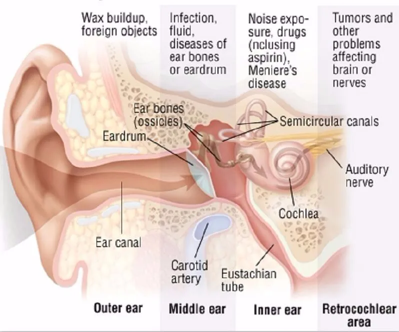 Brand laser medical physiotherapy equipment treatment tinnitus hearing loss ear ringing ear diseases headache relieve device