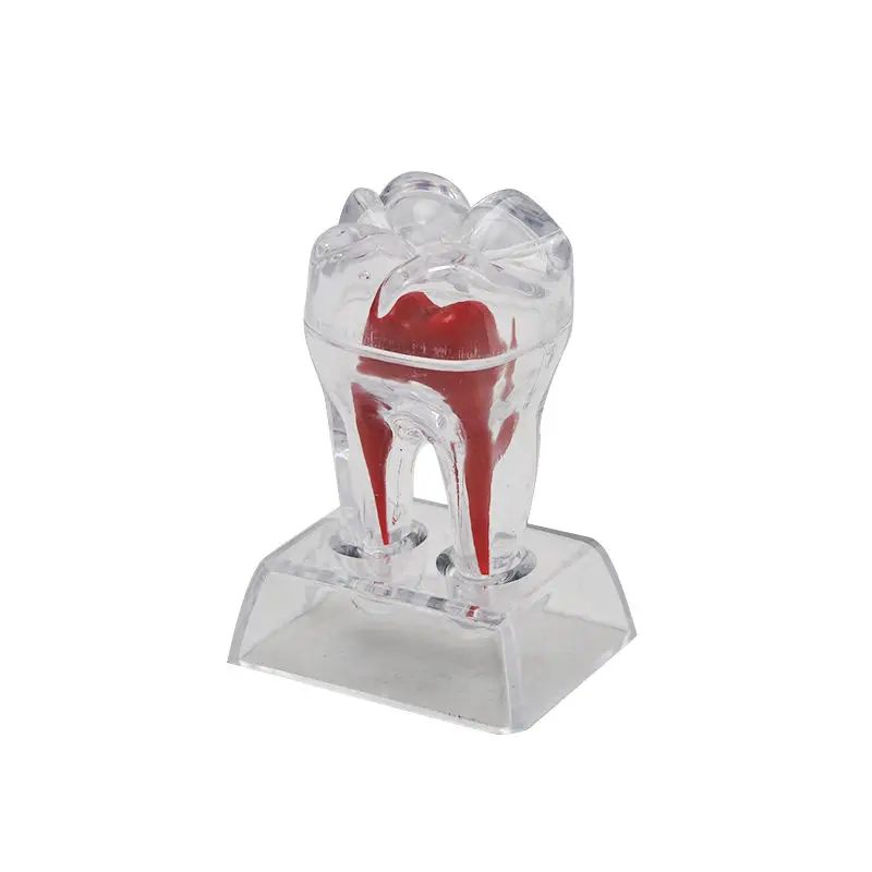 1 шт. маленький стоматологический зубной Кристалл основа жесткий пластик Зубы Зуб Молярная Модель Отделяемая 5,5 см* 5 см* 7 см
