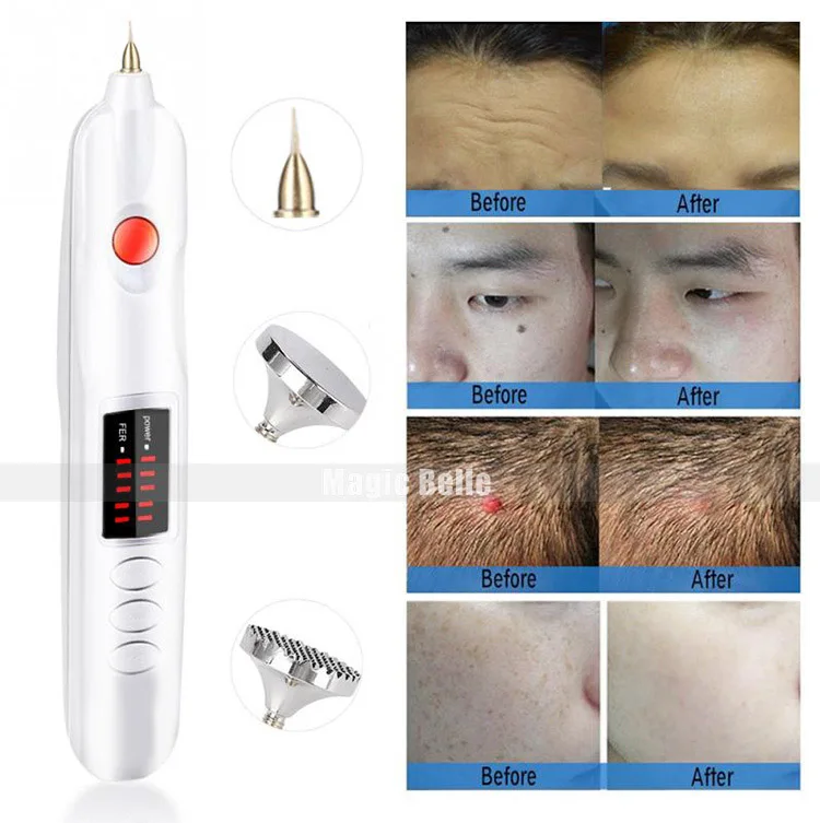 Magic-Plasma pen MA XQ (1)