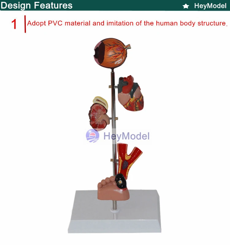 1.PVC_