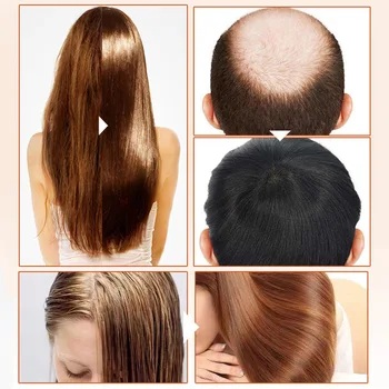 

1 Pcs Hair Growth Essence Preventing Hair Loss Essential Liquid Effective Care Product 88
