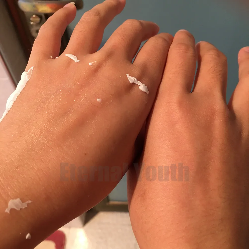 hyaluronic acidIMG_5613