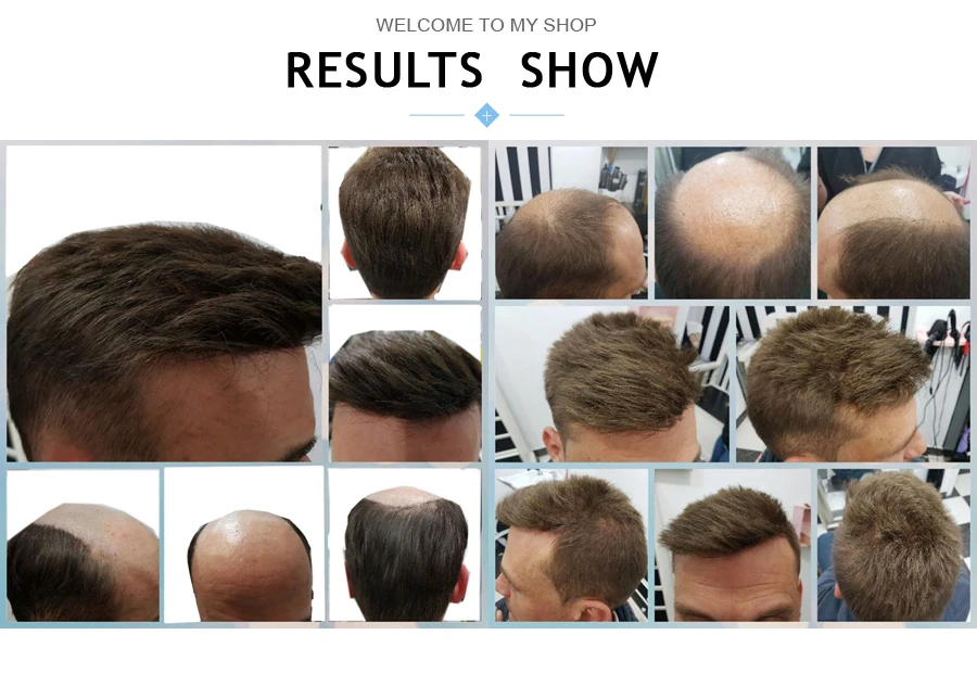 Peruca de Pele Fina Cabelo Humano Homens Peruca Boa Qualidade Pedaço Frete Grátis 17 Peruca de pele fina cabelo humano homens