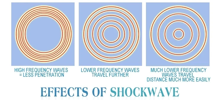 Эффективная акустическая Ударная Волна zimmer shockwave терапия машина функция обезболивания для эрекционной дисфункции/ED лечение