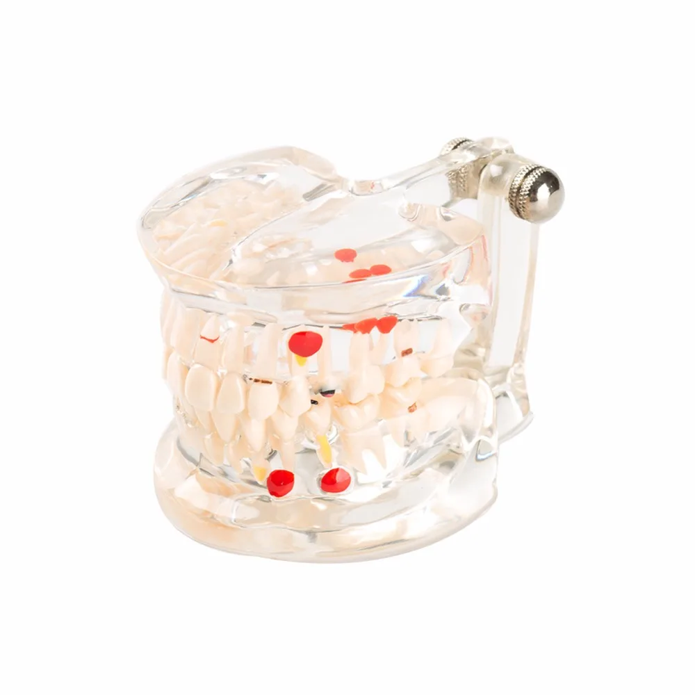 

model of teeth Easyinsmile Half side can be removeble teeth model Patient and Student Education Teeth Model