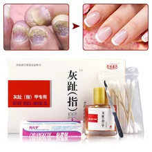 25 мл набор для лечения грибков ногтей Удаление онихомикоза против грибка ногтей Уход за ногтями восстанавливающая жидкость OA66