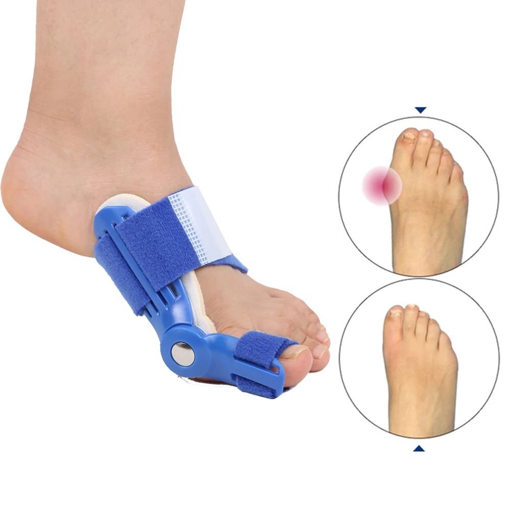 

Hallux Valgus Orthotics Big Toe Corrector Foot Pain Relief Feet Guard Care Bone Corrective Bunion Night Day Splint Straightener