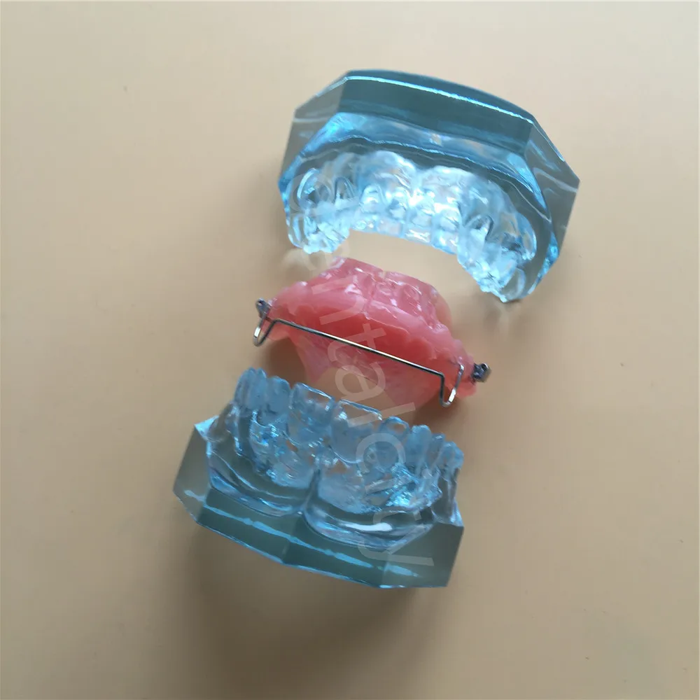 Стоматологический функциональный ортопедический бионатор съемная модель 3006 Стоматологическая обучающая модель зубов