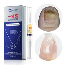 Лечение ногтей от грибка Ручка для ног Уход за ногами решение противогрибковые инфекция ногтей Onychomycosis ногтей восстанавливающая эссенция