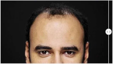 before-11