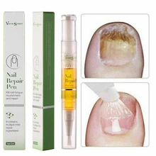 Жидкая ручка для ремонта ногтей грибковая анти-инфекция паронихиа Лечение ногтей дезинфекция ног гриб лечение ног инструмент для ухода за ногами