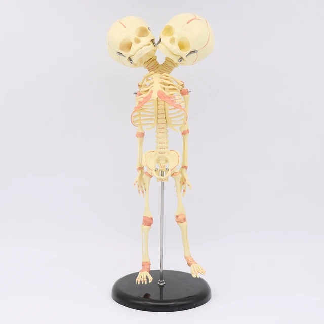 Illustration 3d De L'anatomie De Squelette De Bébé Illustration