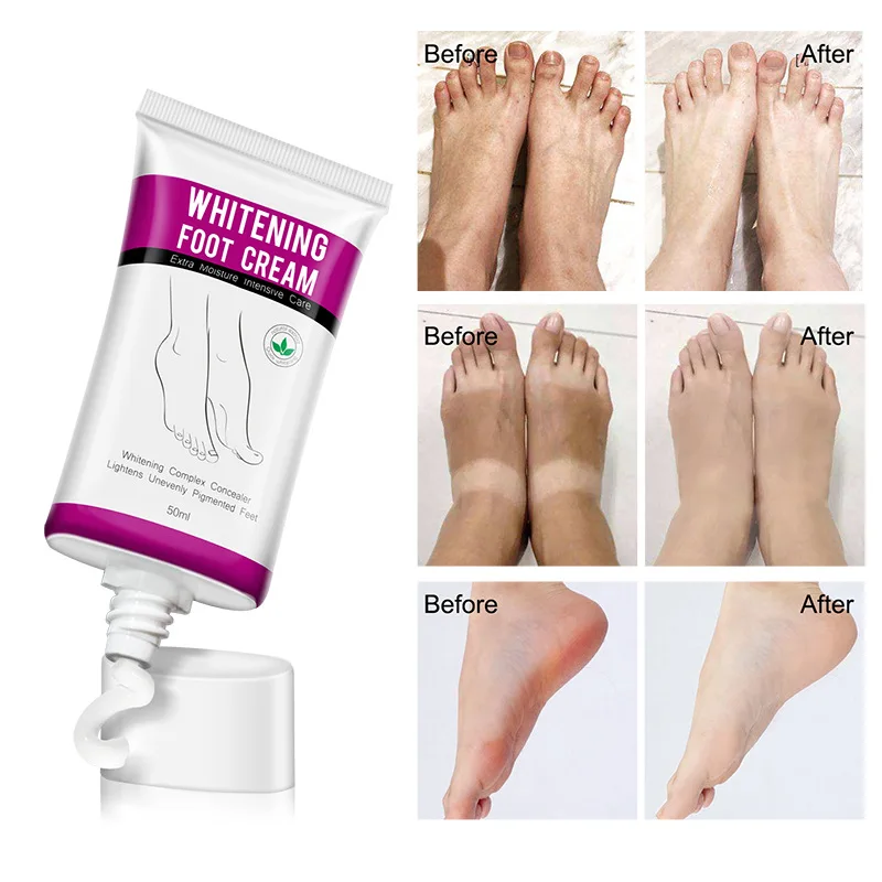 

ALIVER Foot Cream Whitening Cream Moisturizing Care Moisturize Foot Skin Cream Hydrating White Smooth And Delicate Foot Care