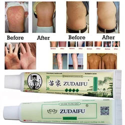 10pcs Dropshipping ZUDAIFU Skin Psoriasis Cream Dermatitis Eczematoid Eczema Ointment Treatment Psoriasis Cream with Box 10pcs Dropshipping ZUDAIFU Skin Psoriasis Cream Dermatitis Eczematoid Eczema Ointment Treatment Psoriasis Cream with Box