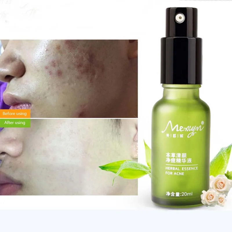 Herbal Essence Repair Natural Serum Spray Face Whitening Moisturizing