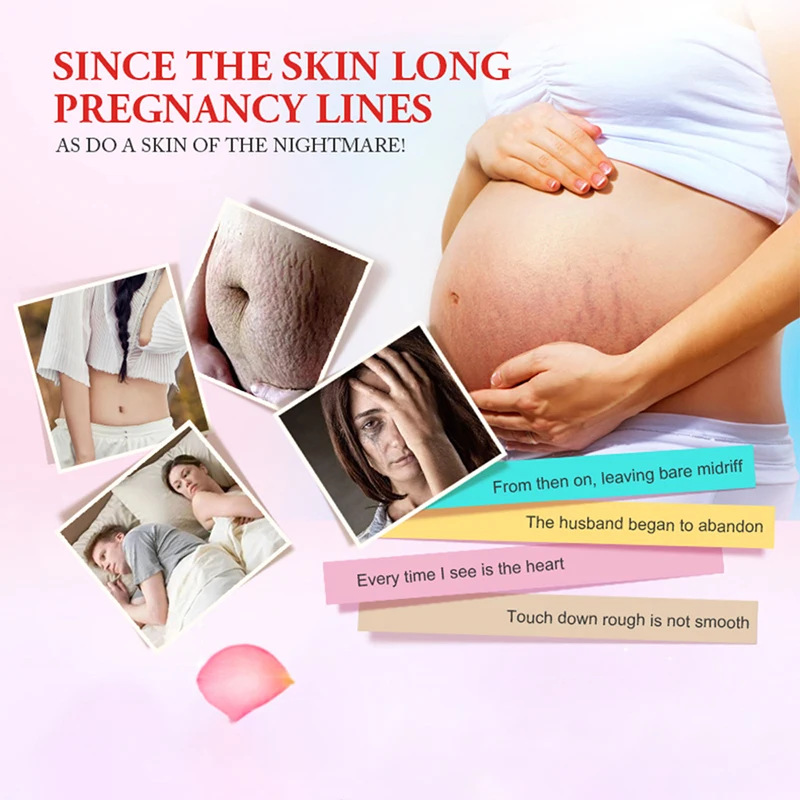 Meiyanqiong уход за кожей тела нежный крем для беременных ремонт кожи средство для удаления растяжек послеродовой крем для тела MY006
