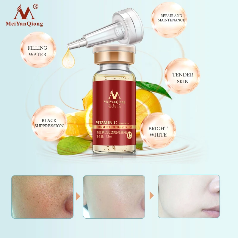 Buy 3 Get 1 Gift Vitamin C Facial Essence Remove Acne Pimples 10ml Anti Aging Whitening Moisturzing Serum Face Care VC Cream Buy 3 Get 1 Gift Vitamin C Facial Essence Remove Acne Pimples 10ml Anti Aging Whitening Moisturzing Serum Face Care VC Cream