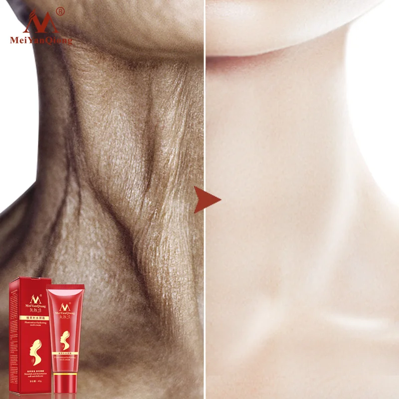 

Beauty Cream Firming Whitening Desalination Deep Yellow Thin Line Moisturizing Whitening Neck Protective Film Anti-wrinkle