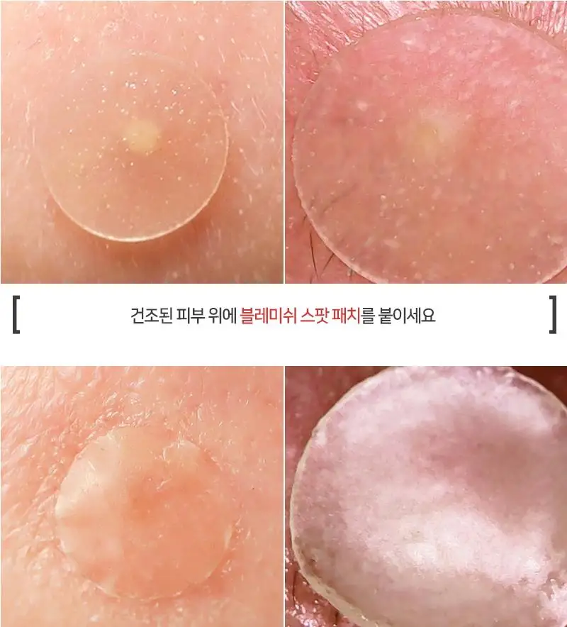 ELIZAVECCA ведьма Копилка Hell Pore пятна пятно патч 44 шт маска для лица шрам ремонт прыщей