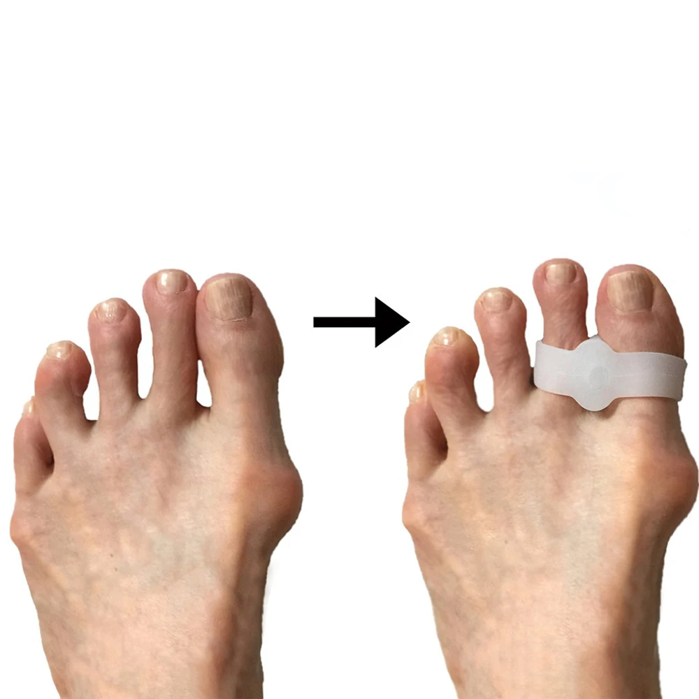 

2Pcs 2 Hole Feet Foot Care Gel Toe Straighteners Separator Hallux Valgus Bunion Corrector Pain Relief Foot Massager C136