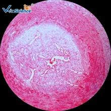 Медицина 100 шт набор человеческих слайды патологии