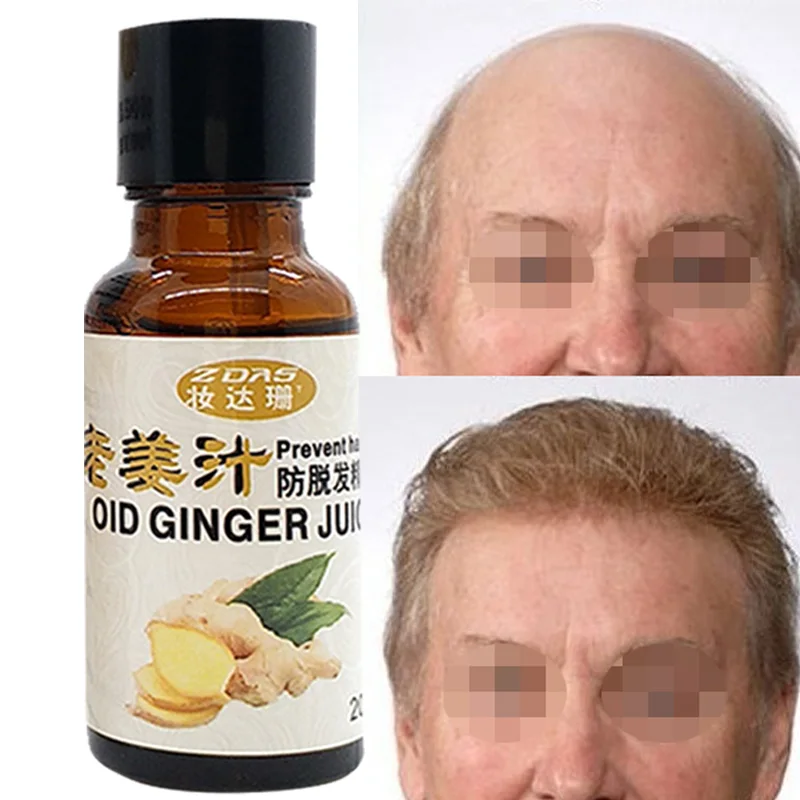 New Herbal medicine Andrea Hair Growth Products Ginger oil Hair Growth