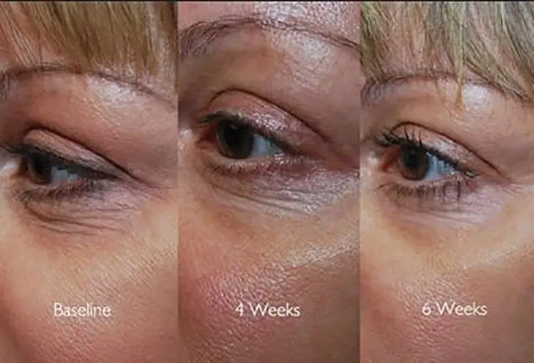 matrixyl 3000 and vitamin c