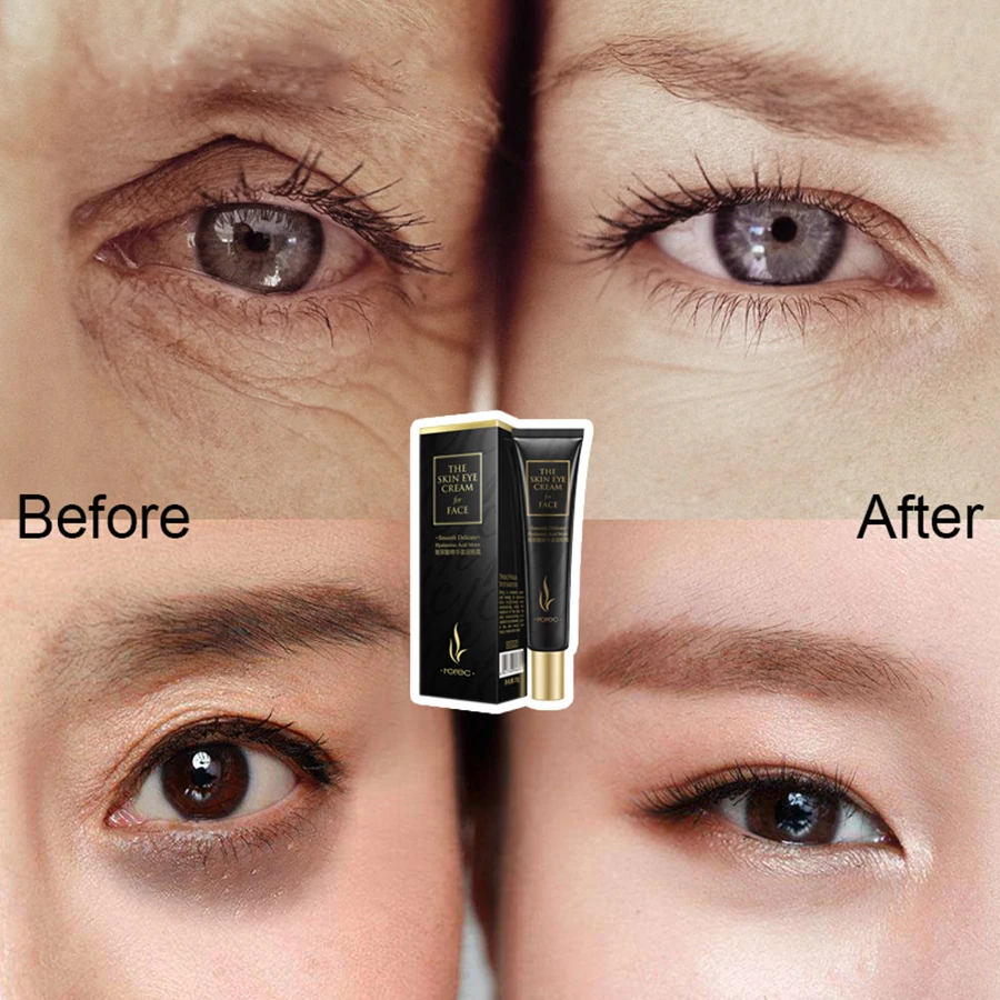 LAIKOU Eye Cream Hyaluronic Acid Eye Serum Wrinkle AntiWrinkle Snail