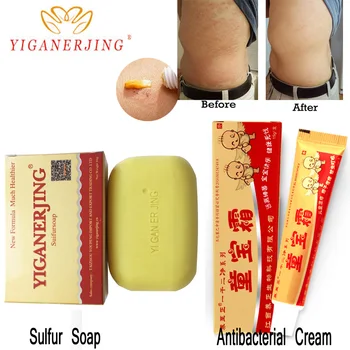 

yiganerjing Sulfur Soap Skin Conditions Acne Psoriasis Cream Seborrhea Eczema Anti Fungus Bath whitening soap shampoo soap