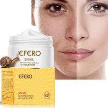 Snail Serum Whitening Cream for Face Skin Care Anti Aging Anti Wrinkle Cream Acne Remover Day Cream Moisturizing Lifting Firming 1set skin whitening snail cream face care ageless reduce scars acne moisturizing anti wrinkle face lift firming cream skin care