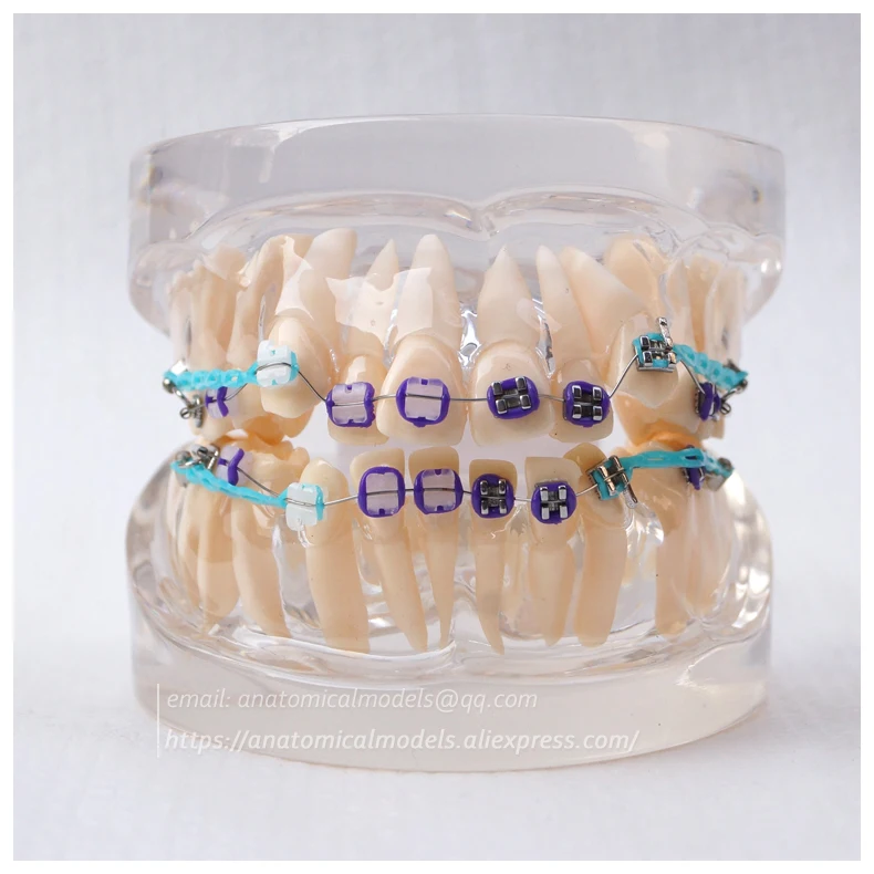 13024 DH202-2 Ortho Metal&Ceramic 1 