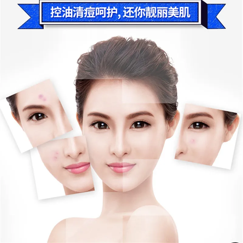 BIOAQUA 1PC Anti Acne Treatment Cream Whitening Skin Care  Oil Control Moisturizing Acne Scar Remover Pores Acne Cream 3