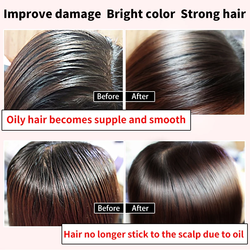 30ML Moroccan Hair Loss Treatment Ginseng Ginger Hair Growth Oil Herbal For Dry Hair Care Types Scalp Herbal Treatment Essence