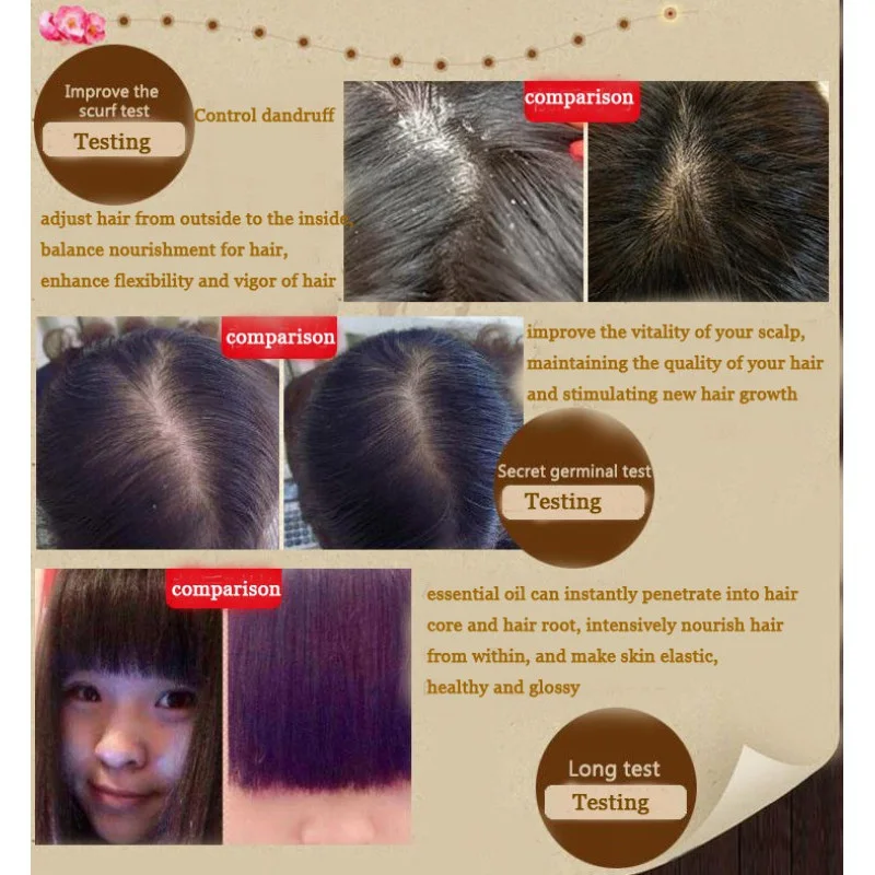 Уход За Волосами Эфирные масла для роста волос эссенция оригинальная Подлинная