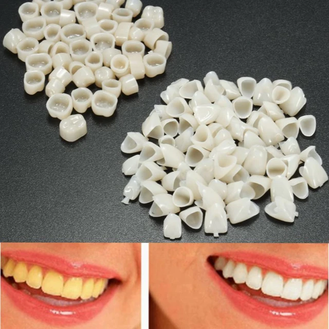 120pcs Dental Temporary Crown Front Teeth Fake Teeth Veneer Tooth  Replacement