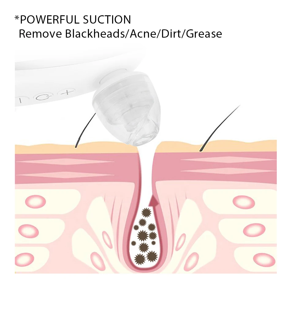 Removedor de Cravo para o Rosto Máquina de Sucção a Vácuo Ferramenta Cravo Acne Pimple Remover Extractor Pore Cleaner Limpeza Profunda Facial 17 Limpeza Profunda Facial Máquina de Sucção A Vácuo