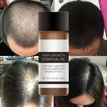 20 ml Schnelle Haar Wachstum Essenz Produkte Ätherisches Öl Flüssigkeit Behandlung Gegen Haarausfall Haarpflege Andrea