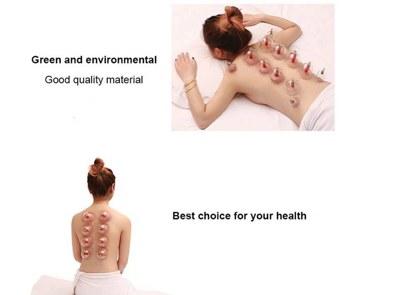 vacuum cupping (11)