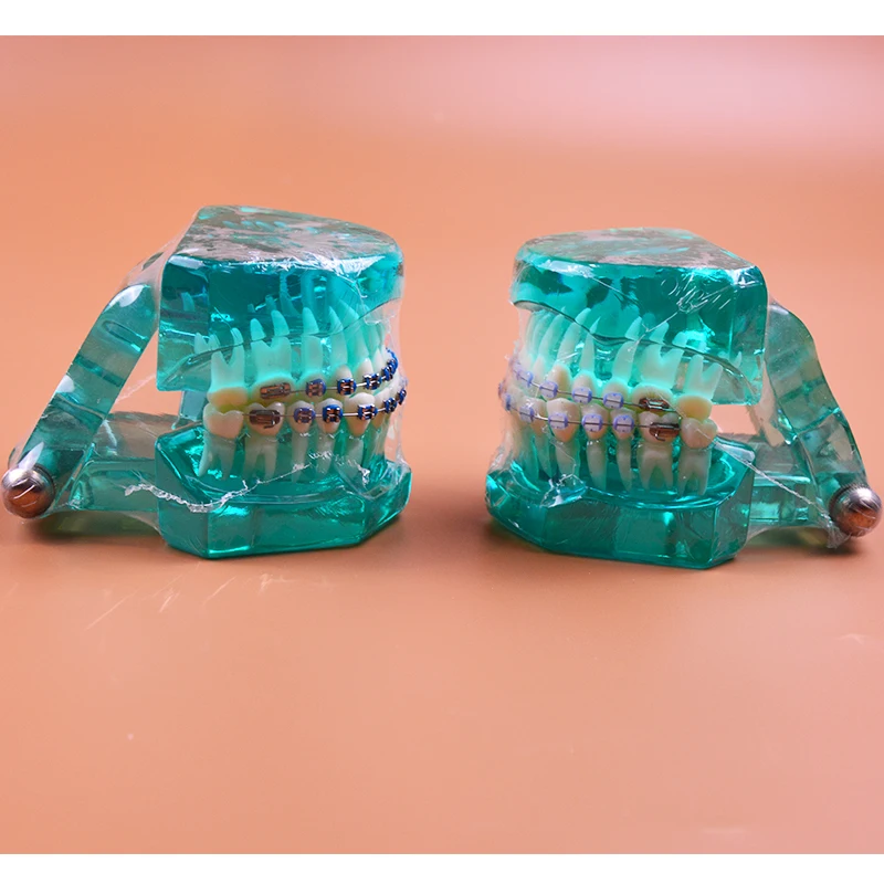  B7-02 Orthodontics Malocclusion Braces Dental Acrylic Teeth Dental Teaching Model Ortho Metal & Cer - 32626113795