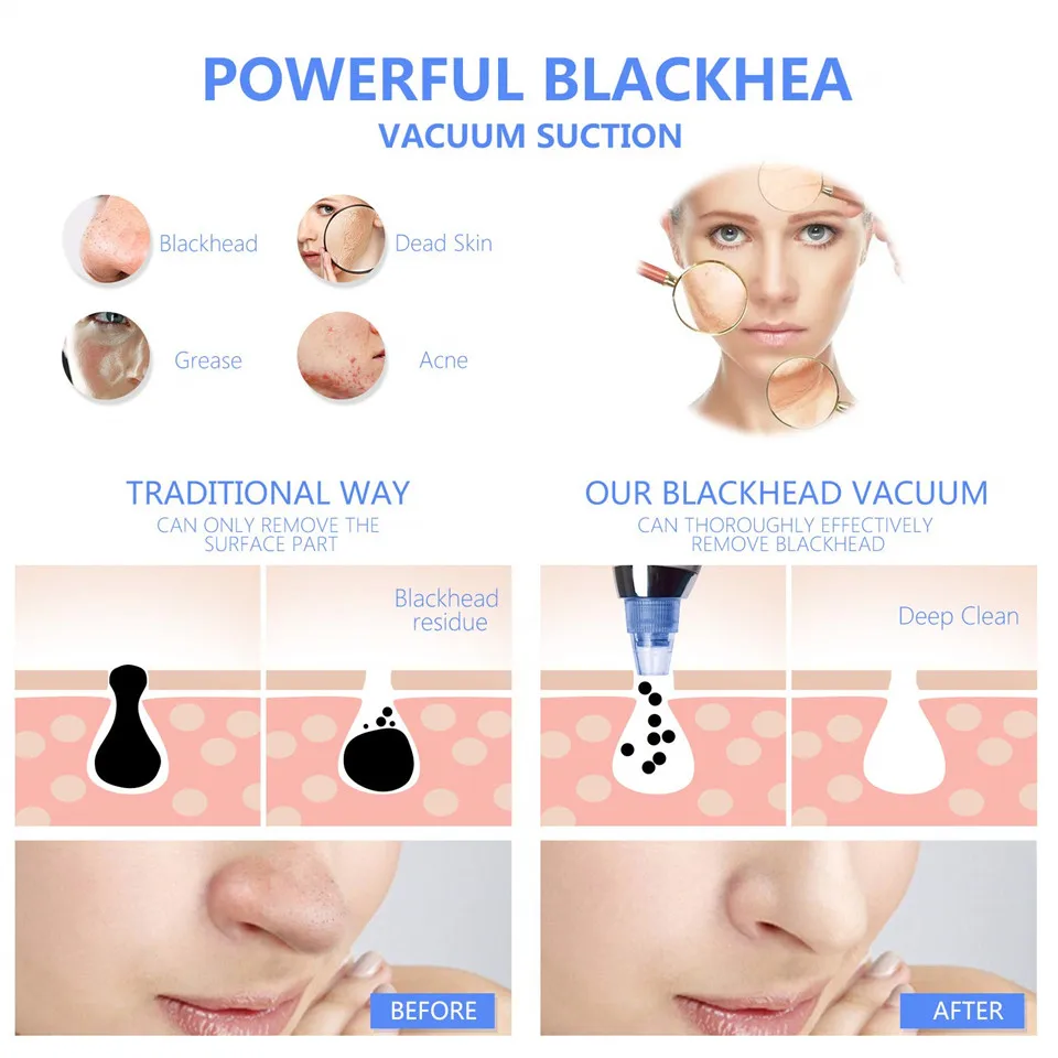 Пылесос Blackhead всасывание удаление пилинг для пор Очистка носа уход за кожей красота алмаз дермабразия средство для устранения черных точек