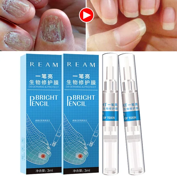 Hot Sale 3ml Nail Fungus Treatment Liquid Toenail Anti Fungal Nails Care Portable Nail rehydration solution