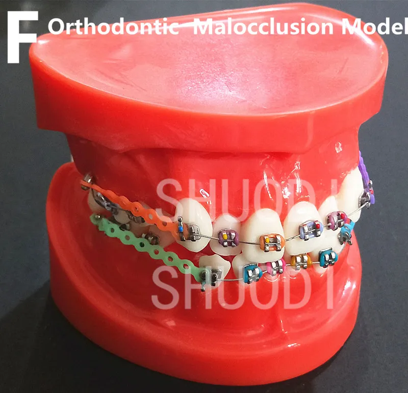 Стоматологический уход за полостью рта модель зубов Стоматологическая Ортодонтическая модель для связи пациента Стоматологическая модель исследования - Цвет: 1 piece F