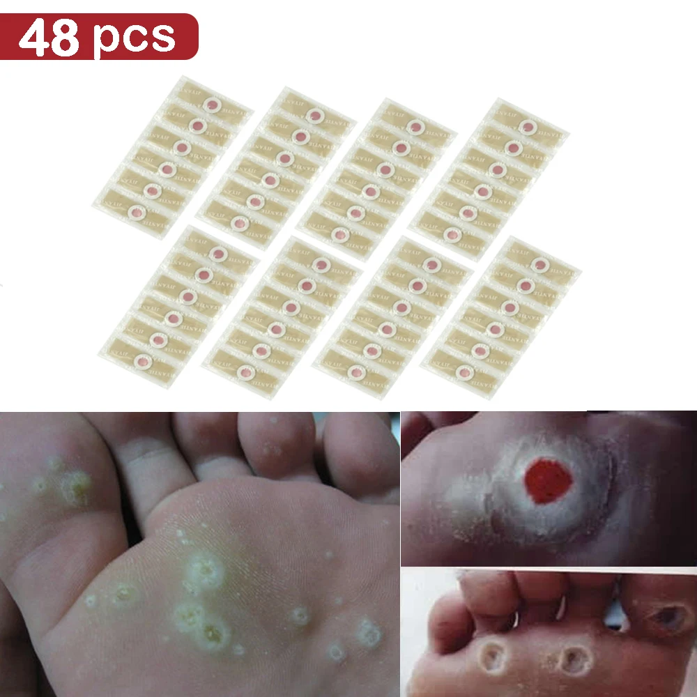 48pcs Foot Plaster Corn Removal Remover Warts Thorn Plaster Health Care For Relieving Pain Calluses Plaster