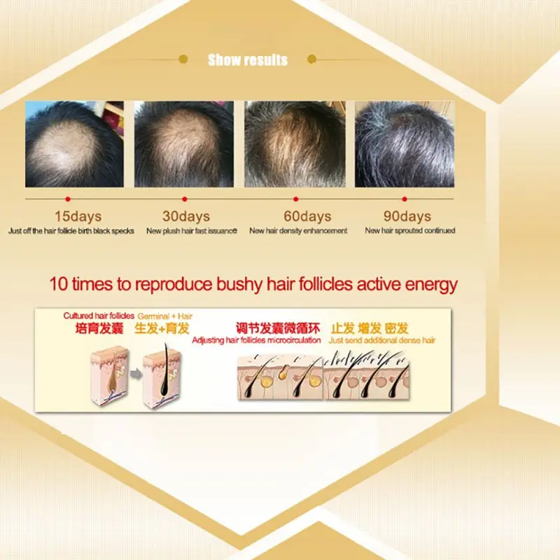 30 мл чистая натуральная эссенция лечение волос для сухого и технического обслуживания питание для волос эфирное масло для волос
