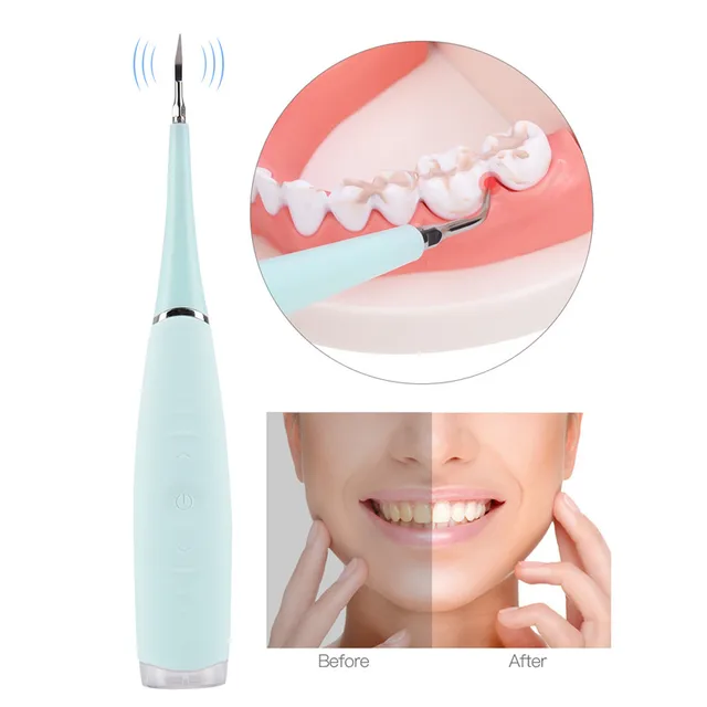 Home Electric Vibrating Oral Dental Cleaner Teeth Cleaning Machine Calculus Removal Tartar