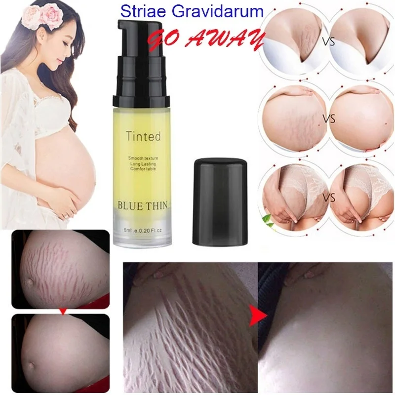 

6ML Remove Pregnancy Scars Cream Maternity Repair Stretch Marks Skin Repair Moisturizer
