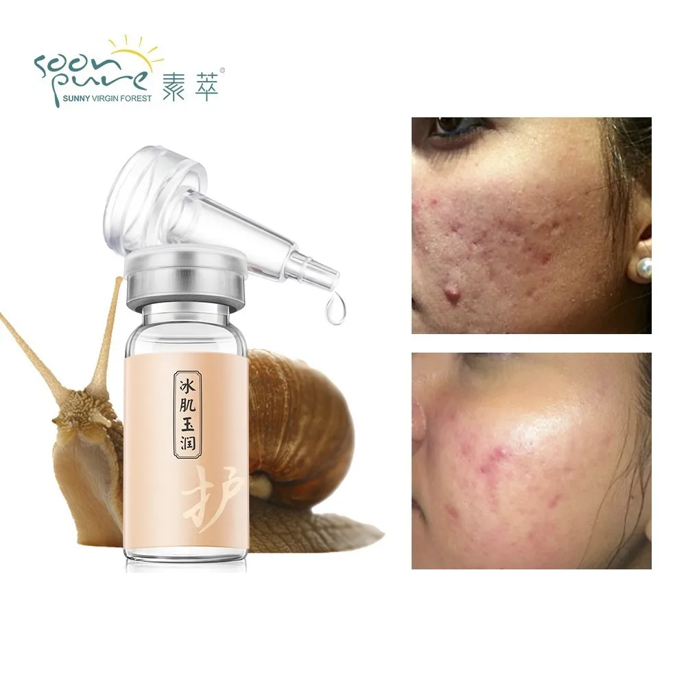 

SOONPURE Snail Repair Serum Skin Care Whitening Moisturizing Acne Treatment Blackhead Remover Anti Aging Facial Treatment