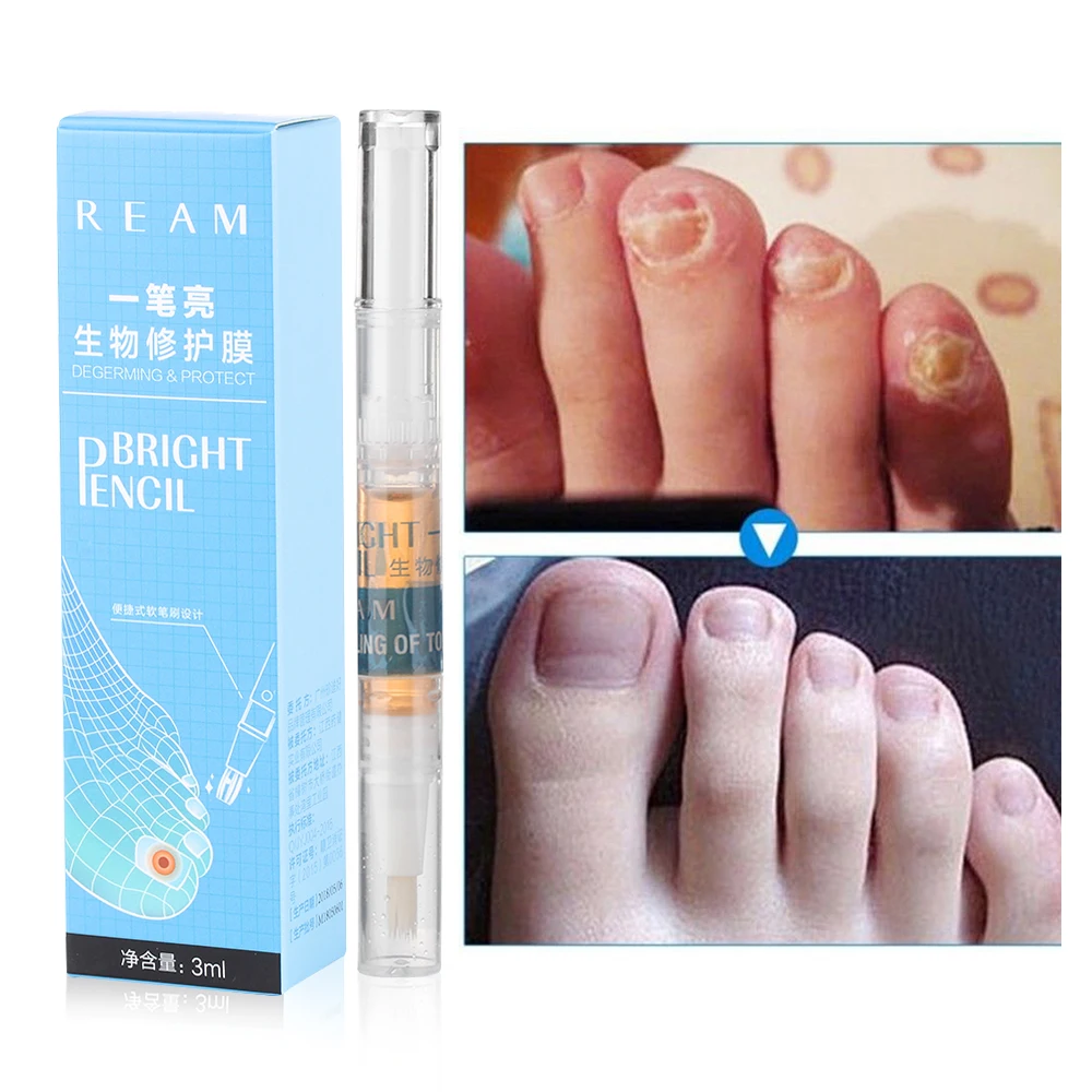 

1Pcs Bright Nail Finger&Toe Nails Repair Nail Treatment Liquid Pen Cleaning Nail Care Essence