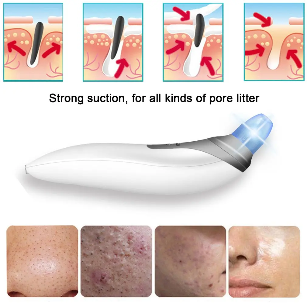 

ABS Skin Care Massage Professional Electronic Facial Pore Cleaner Nose Blackhead Cleansing Acne Remover Comedo Suction Tools