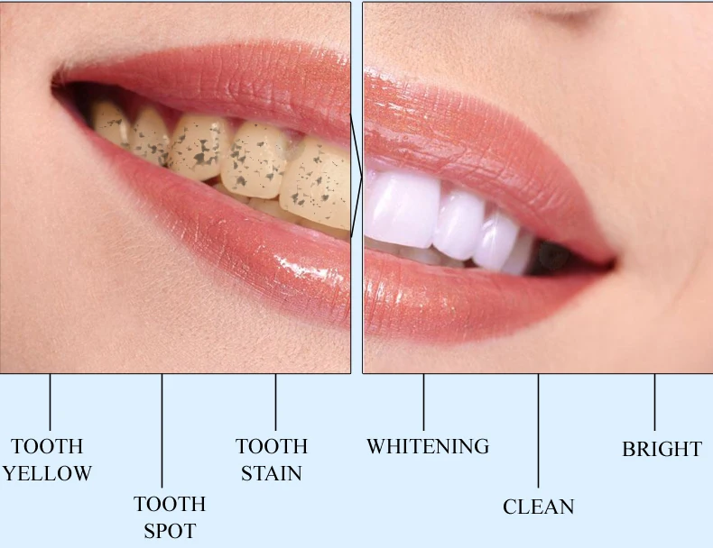 10 шт./лот отбеливающая эссенция для чистки зубов Гигиена полости рта удаляет зубные пятна увеличивает стоматологический блеск Защита зубов